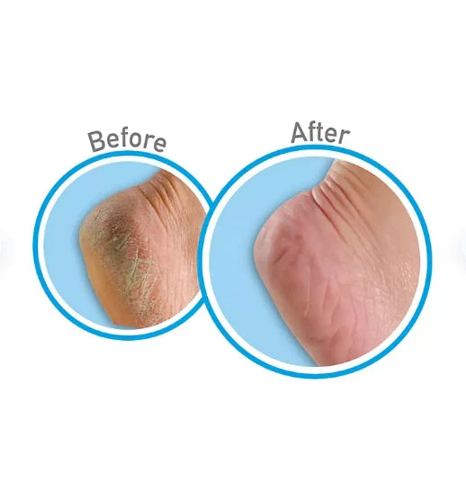 O'Keeffe's Healthy Feet and Lip Repair Variety Kit
