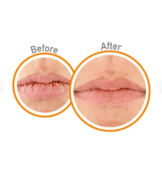 O'Keeffe's Healthy Feet and Lip Repair Variety Kit