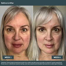 No7 Future Renew Damage Reversal Facial Serum Kit